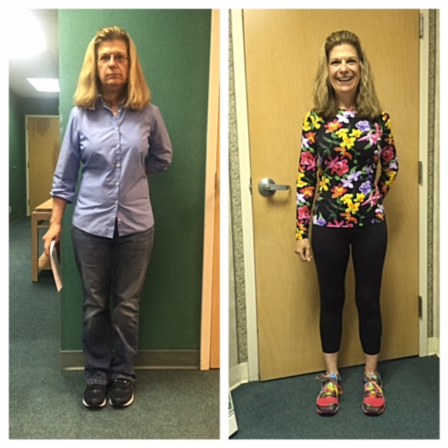 Pam Marden front view before and after image