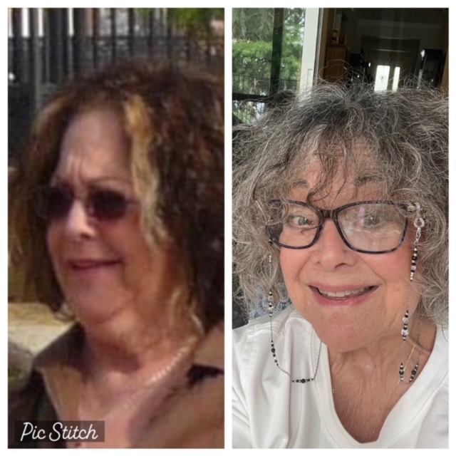 shelby poiley before and after 2 Testimonial weight management bestweightonyou
