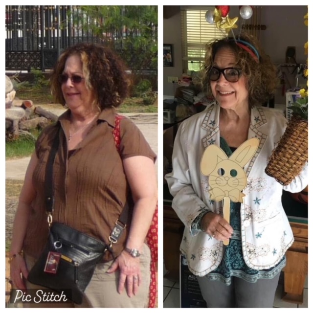 shelby poiley before and after Testimonial weight management bestweightonyou